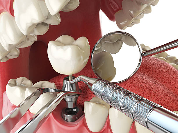 Best Tooth Infection Emergency Dentist  in Crestwood, KY